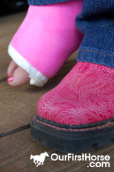 Broken Foot Pink Cast Broken Foot Pink Cast